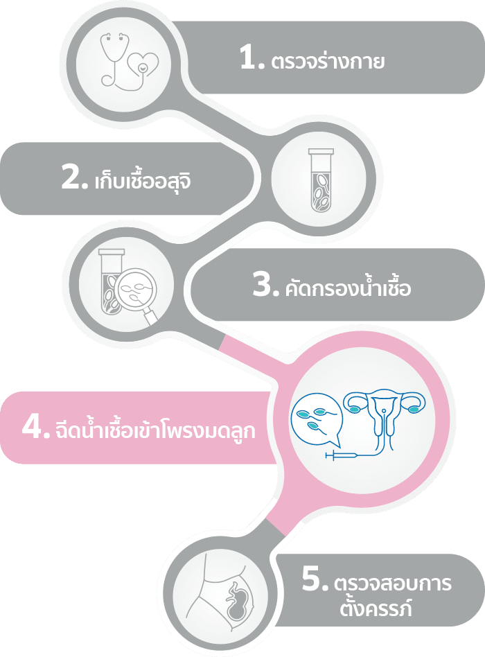 喔傕副喙夃笝喔曕腑喔權竵喔侧福喔椸赋 IUI