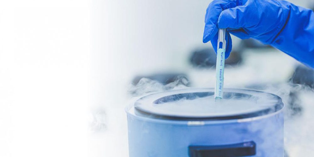 Egg Freezing service