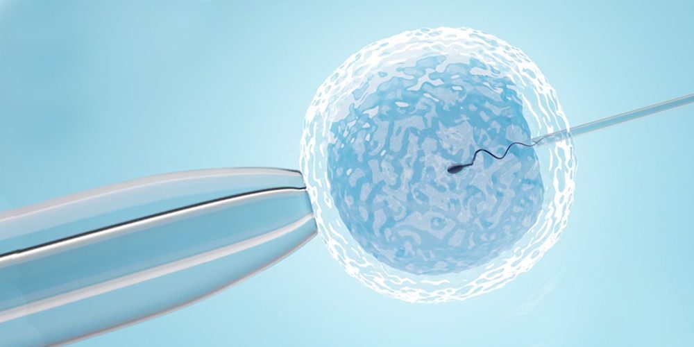 การทำเด็กหลอดแก้?(IVF/ICSI)